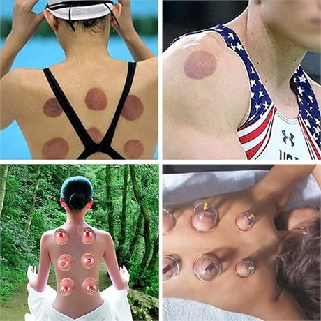 24 Cups Cupping Therapy Sets with Pump Vacuum, Professional Chinese Cupping Set for Body Massage, Muscle Joints Pain Relief, Physical Therapy